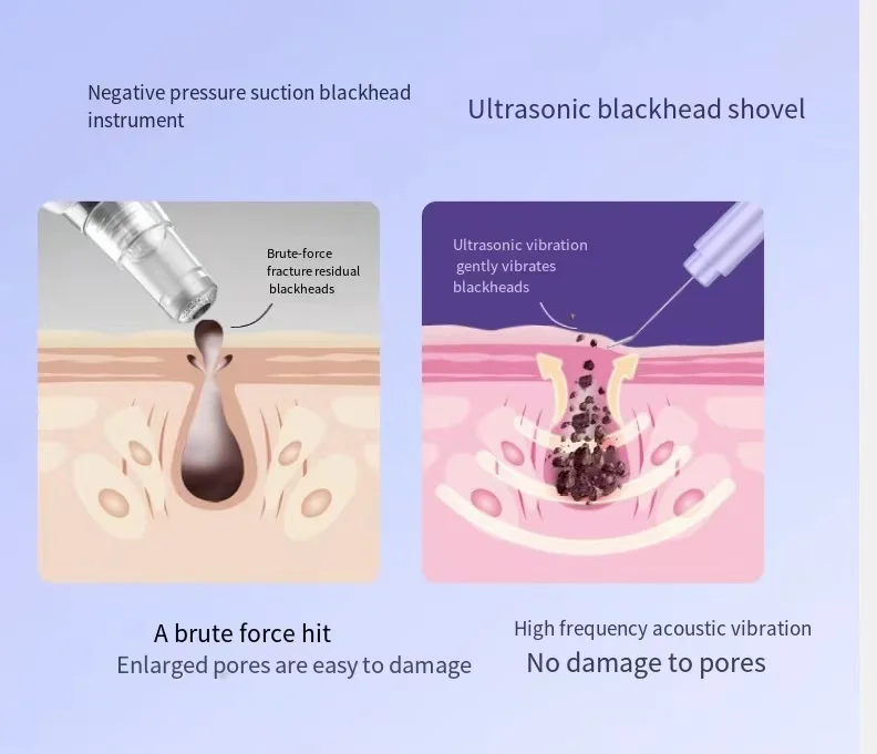 Facial Deep Cleaning Device Portable Ultrasonic Skin Scrubber Spatula Blackhead Remover Pore Cleaner Face Scraper Comedone