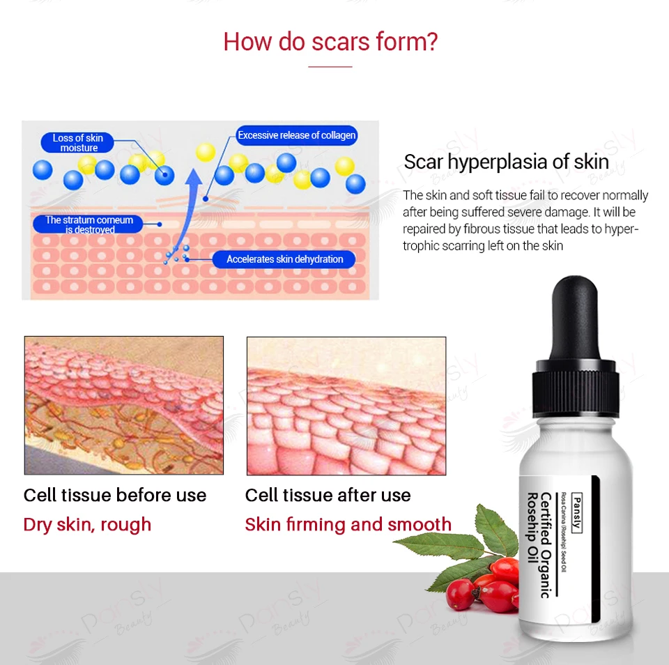 Wholesale Private Label Skin Care Rose Massage Rosehip Oil For Face Body And Hair