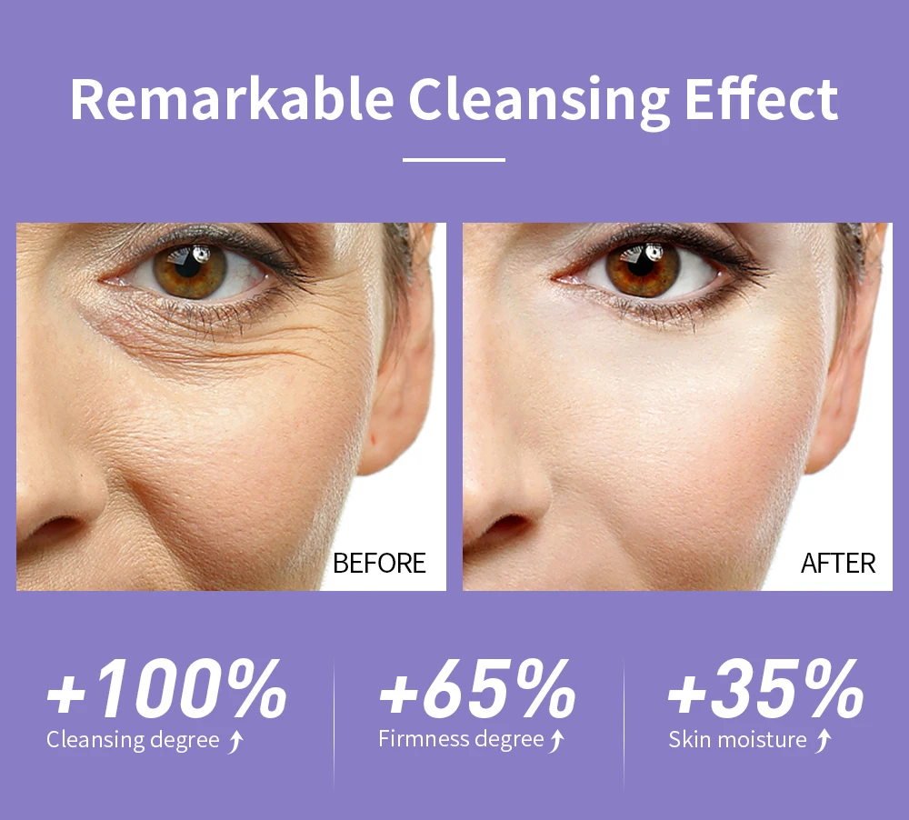 LANBENA thailand himalaya collagen face cream wholesale golden pearl whitening smooth dark spot remover cream face