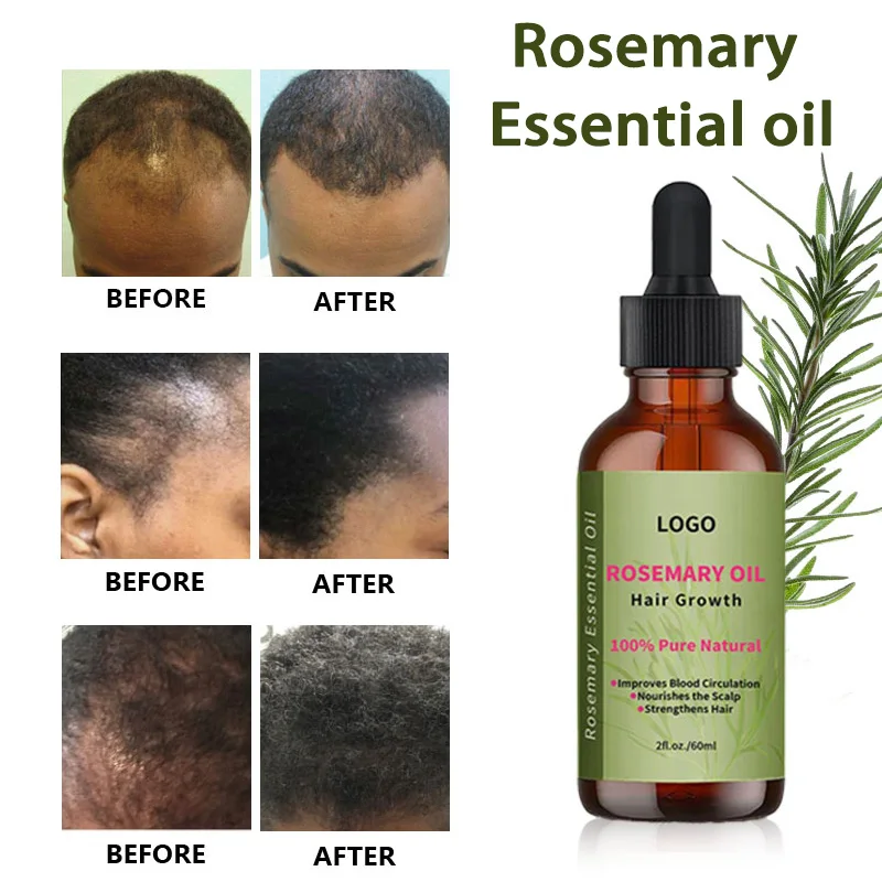 private label black women hair care treatment strengthening rosemary essential oil organic rosemary oil hair growth