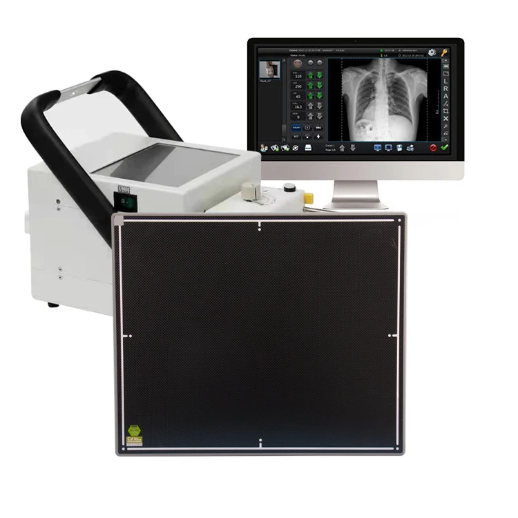 Medical 50Kw LCD Display Portable X Ray Machine Digital X-Ray System Rayos X Portable