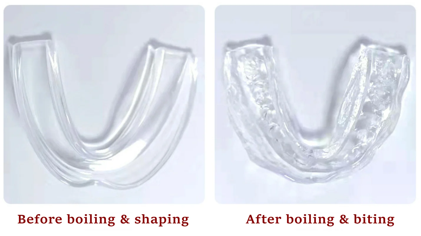 Adults Kids Custom Combo Mouthguard Thin Teeth Grinding Mouth Guards Sleep Aid Teeth Protection Gum Shields Bruxism Mouth Piece