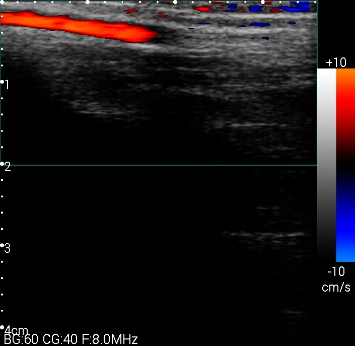 
1280*720 High Resolution Pocket Color Ultrasound Device Mini Handheld WIFI Ultrasound USB Probe 