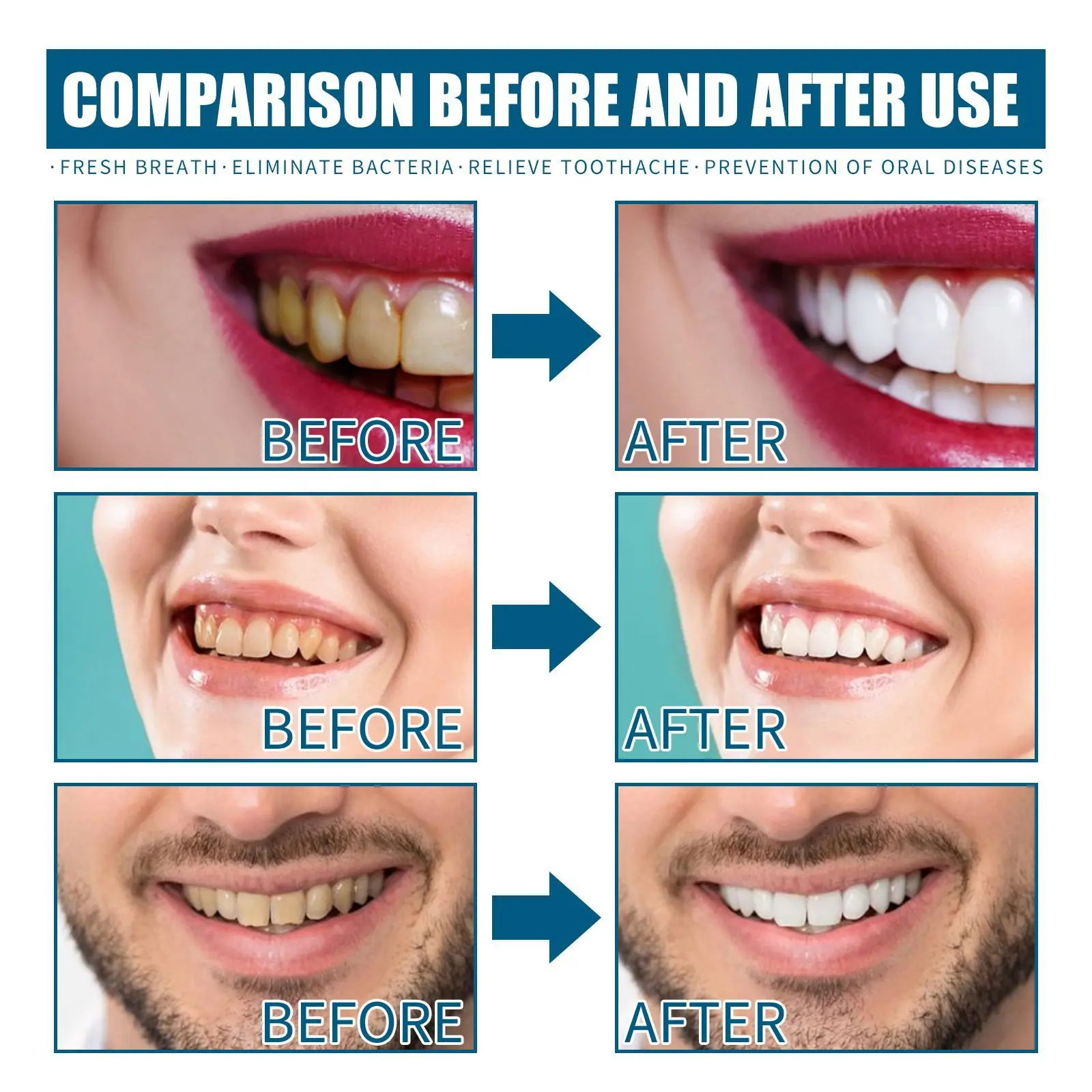 Mouthwash removes tooth stains, removes odor, and refreshes oral hygiene  to maintain oral health mouth wash