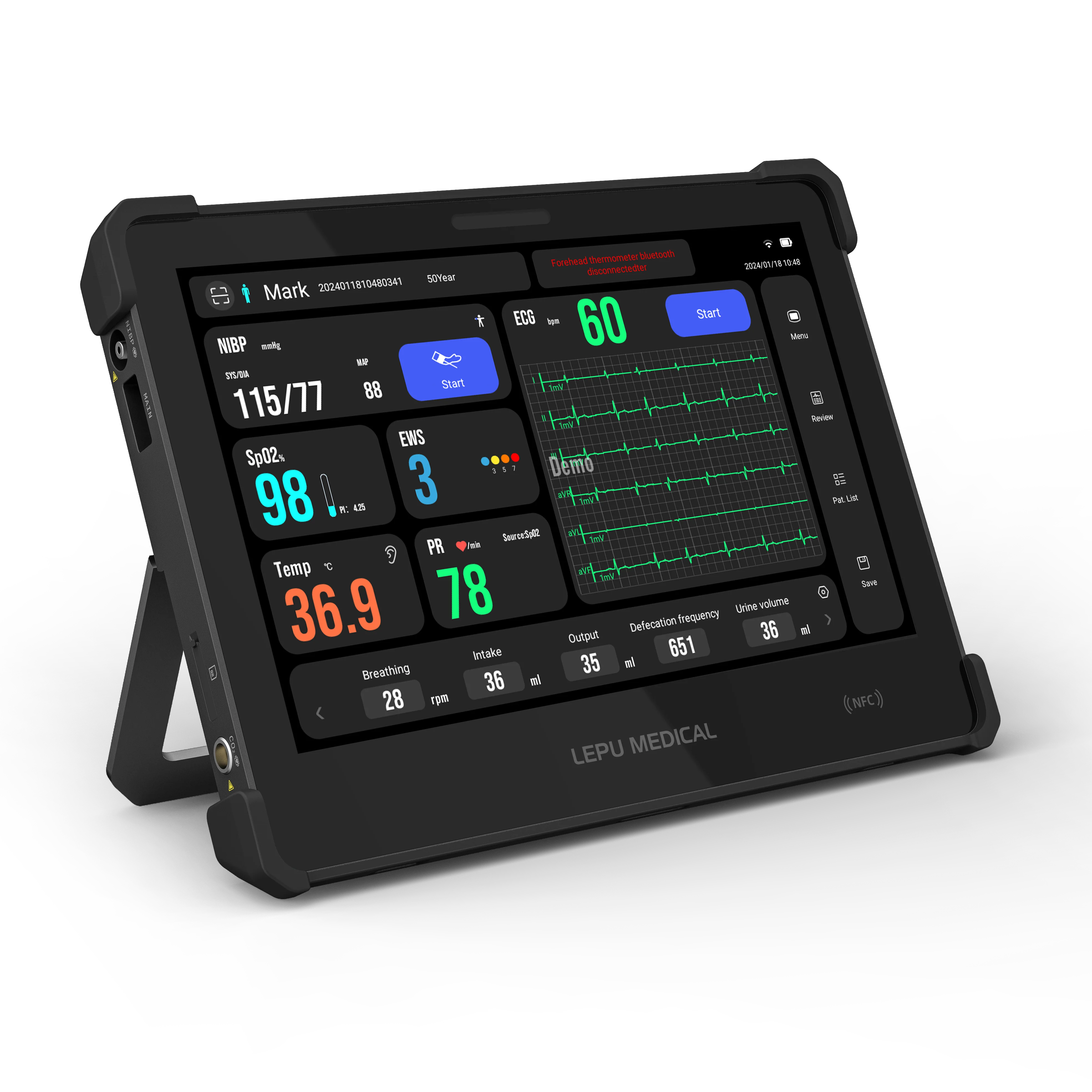 AI Analysis Portable Tablet Vital Signs Monitor for Outpatient, Triage Desk, Emergency and Ward Rounds