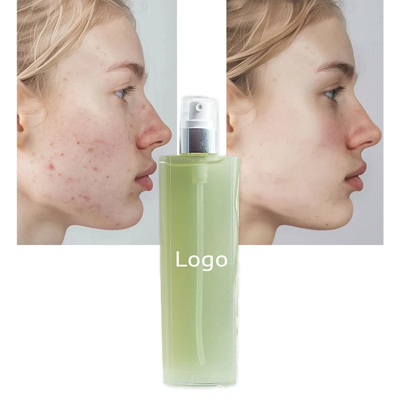 Cosmetics Soothing Moisturizing Aloe Vera Gel Forever Factory Price Thailand Aloe Gel Vera