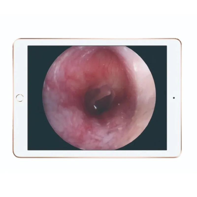 Medical Standard Monitor LED Light Wifi Endoscope Source Capsule Endoscopy System Endoscope Camera