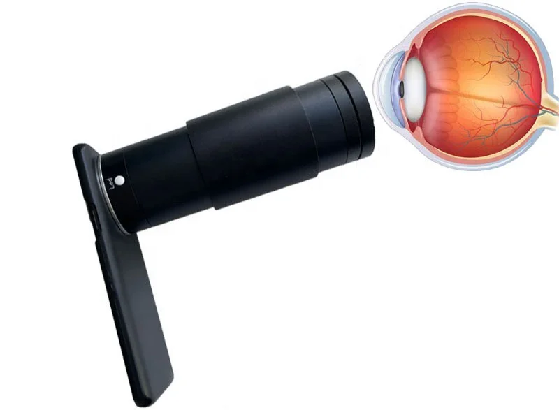 Portable Non-mydriatic fundus camera for ophthalmology, Non-mydriatic for fundus camera portable type