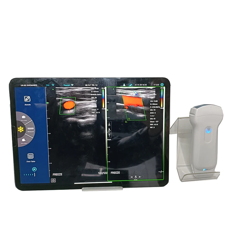 Konted C10rl 3 In 1 Ultrasound Scanner Dual Linear Convex Portable Ultrasound With Color Doppler