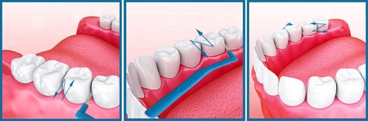 factory  directly supply 5pcs blister card package top quality L shape interdental brush