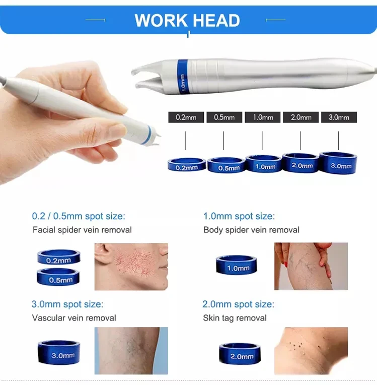 Red Blood Vessels 980nm Spider Veins Removal Diode Laser 980 nm Varicose Veins Laser Treatment Machine