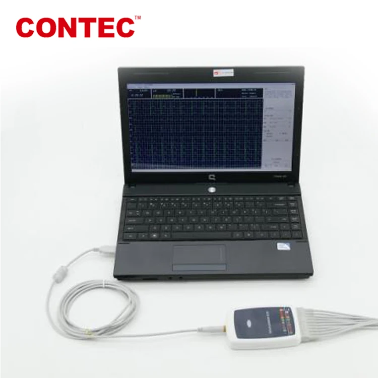 CONTEC8000G CE сертификаты совершенно новая система записи ECG на основе ПК 12 ведущих анализаторов