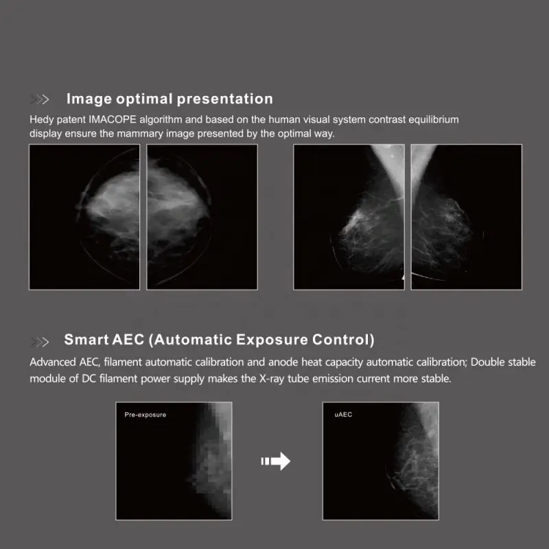 Mammography  digital mammography equipment price machine x-ray units