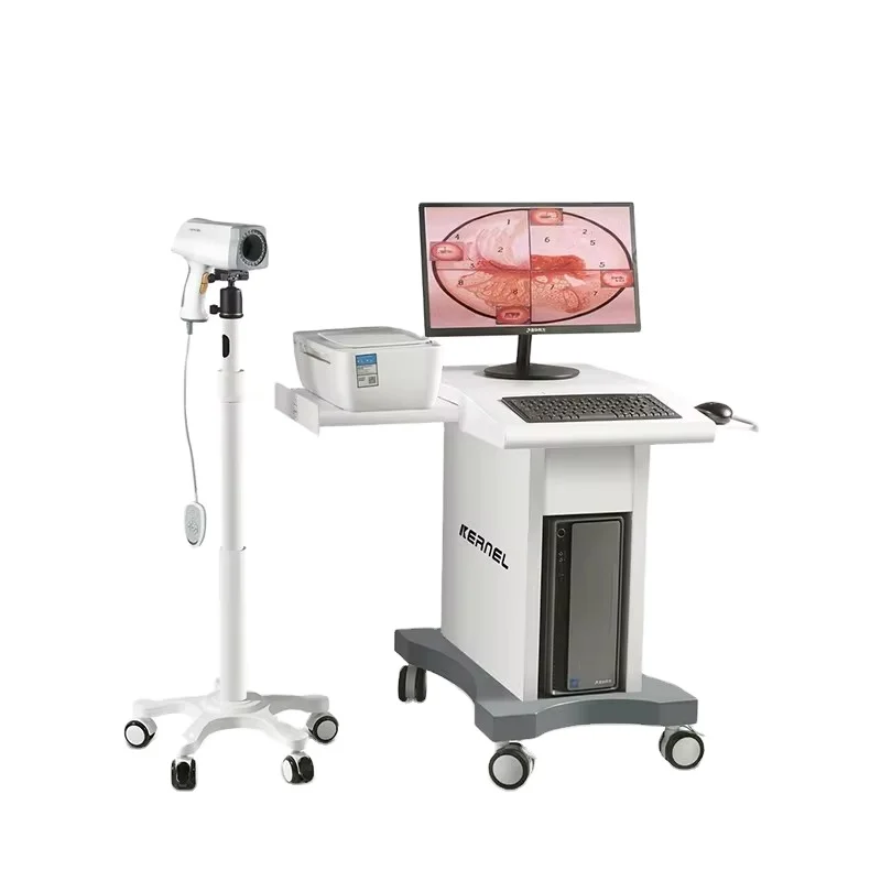 High resolution colposcope video camera colposcopy exam system digital colposcope