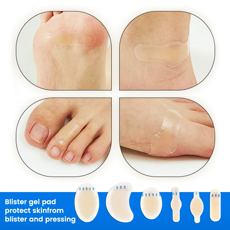 Hydrophilic  Wound dressing  for foot under  Accelerated wound healing Hydrocolloid plaster