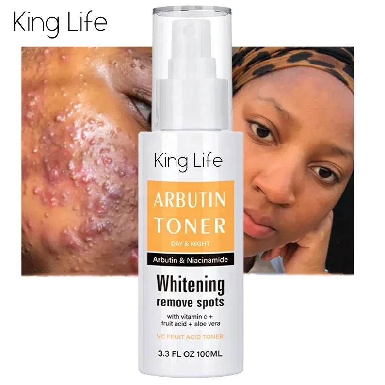 OEM Private Label Moisturizing Facial Skin Care Skincare Organic Pure Vitamin C Facial Face Toner for Face