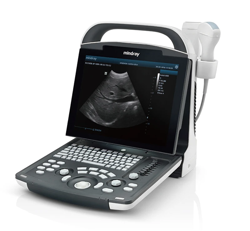 Mindray  DP-10 Ultrasound Machine Of New Generation Doppler Ultrasound System