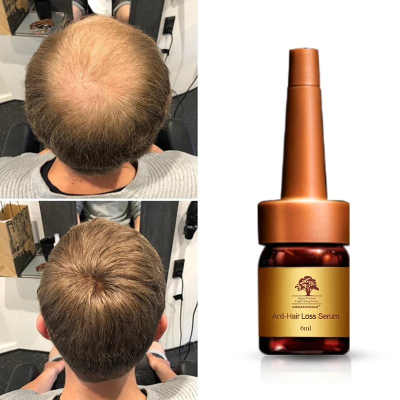 Hair Grow Up Products To Make Your Hair Growth Herbal Treatment Oil Growing Shampoo