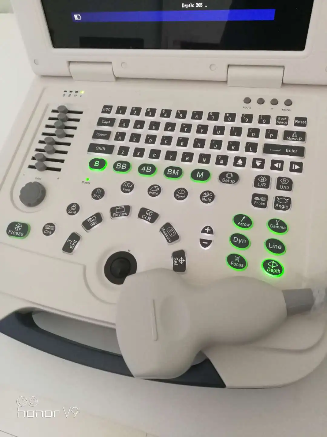 DW-580 low price portable ultrasound scanner & medical equipment