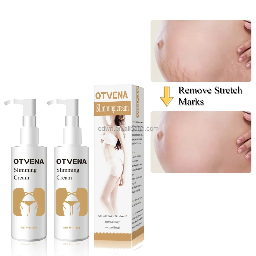 No Exercise No Dieting 100% Weight Loss Product Legs And Hands Slimming Hot Cream