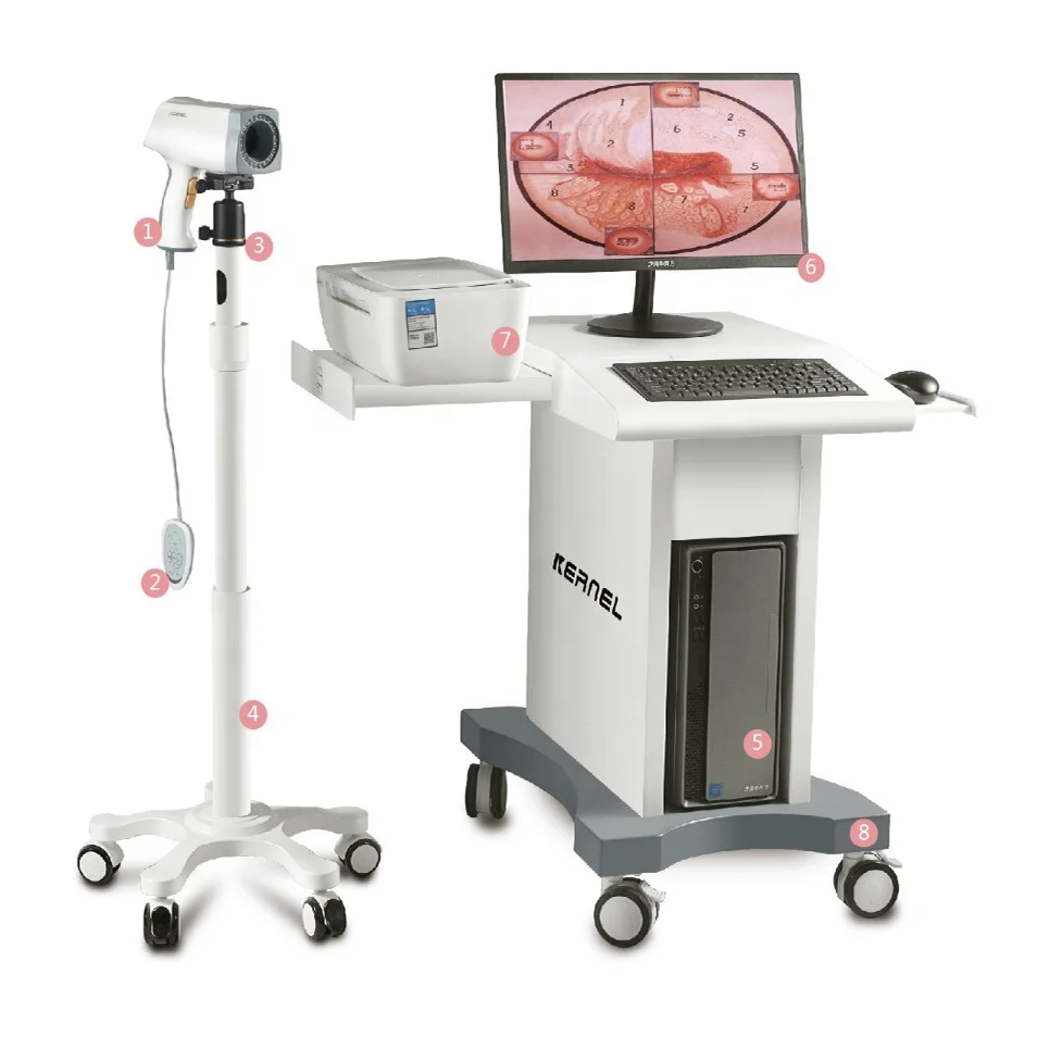 High resolution colposcope video camera colposcopy exam system digital colposcope