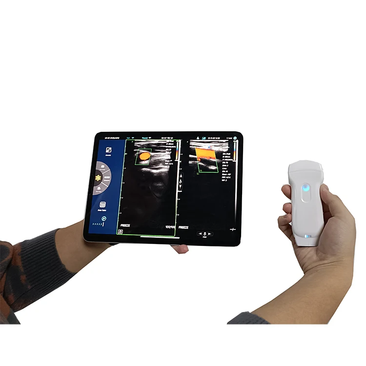 Medical Ultrasound Instruments Usg Portable Wireless Probe Electric Plastic Ce Color Doppler Ultrasound Price 256 Level Class II