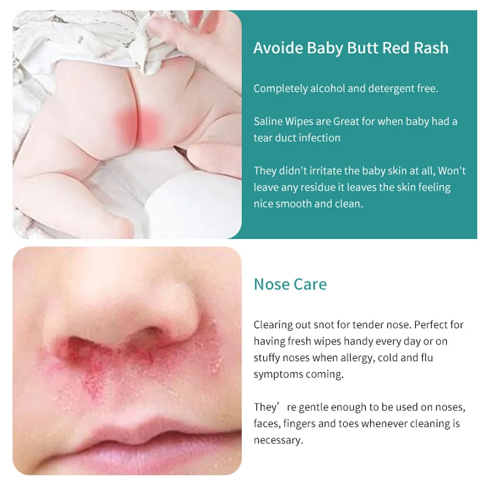 Purcotton Custom Logo Hypoallergenic Baby Saline Nose Gum Pacifier Wipes Unscented Saline Baby Wipes