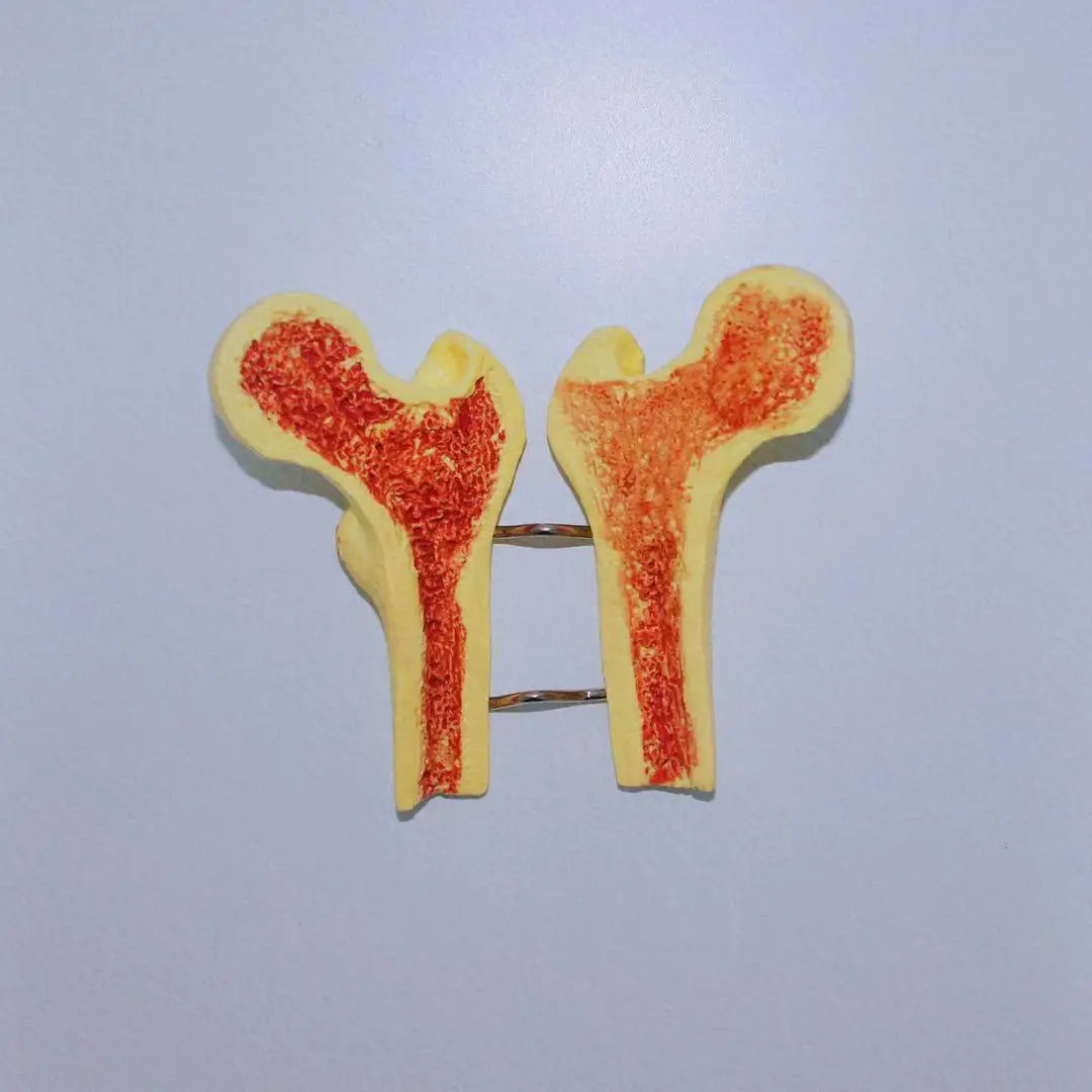 2021 new listing made of durable materials dedicated to teaching osteoporosis skeleton model