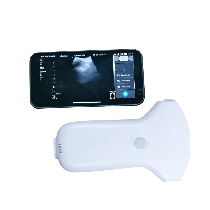 SY-A052C Doppler Scanner Portable Wifi Ultrasound Wireless Convex Linear Probe HD Wireless Ultrasound Diagnostic