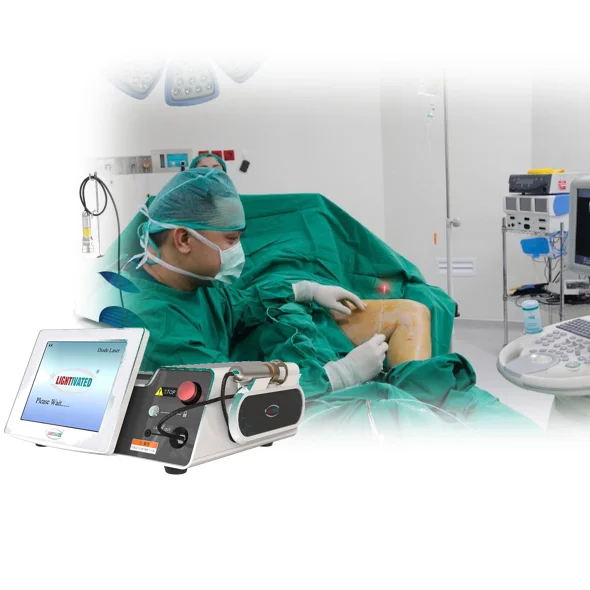 varicose veins Reticular veins or spider veins 980nm EVLT treatment 1470nm diode laser machine trophic ulcer venous nodes remove