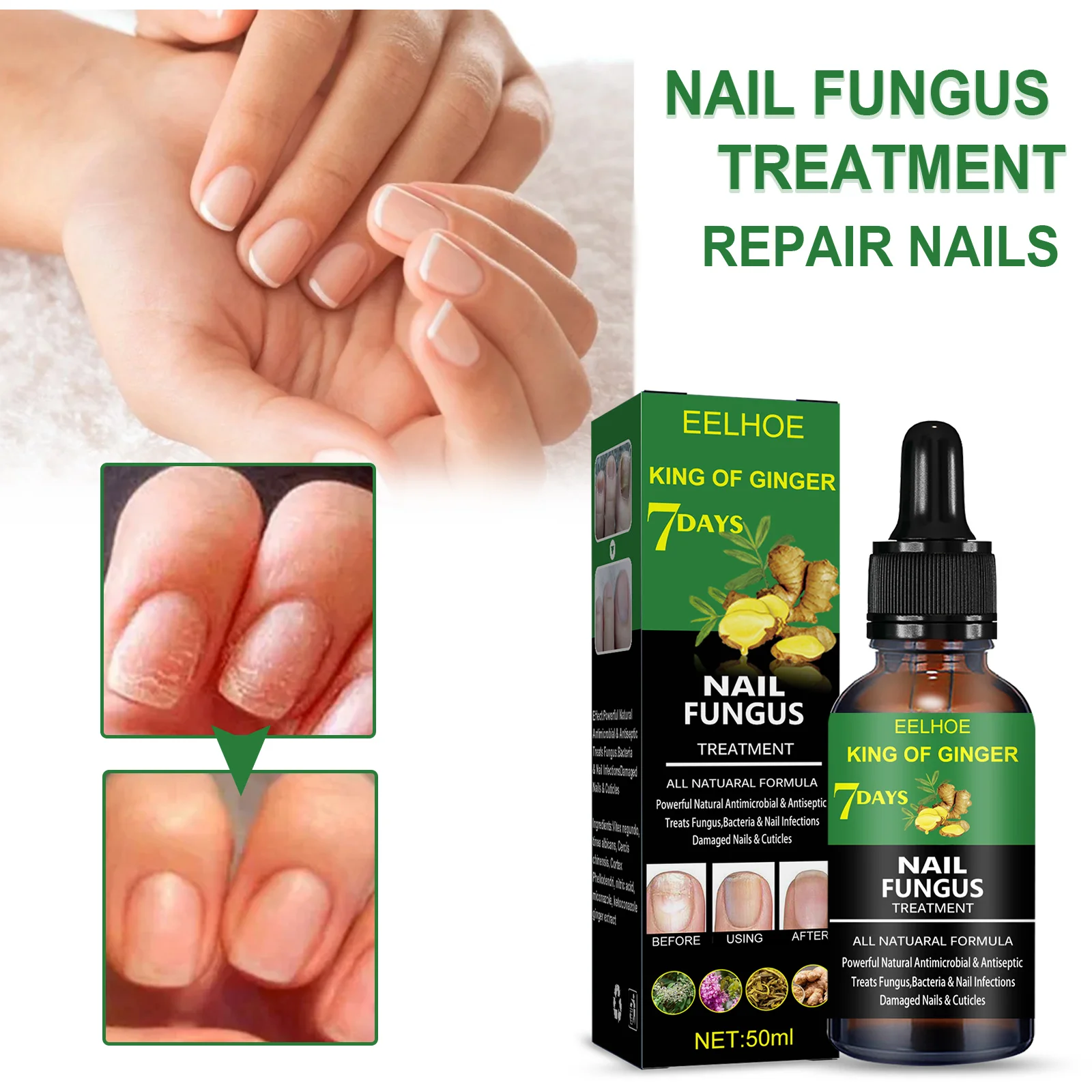 EELHOE 50ml New Herbal Care Hydrate Anti Fungal Nail Cream Quick Results Clean and Whiten Nail Repair Nail Fungus Treatment