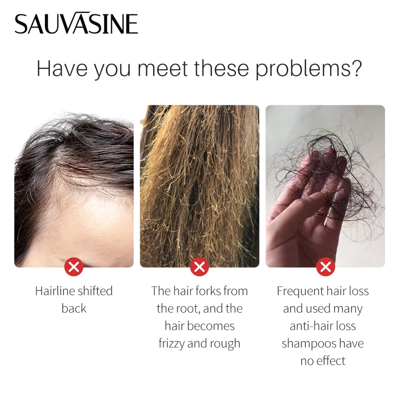 Private Label Hair Treatment Growth Serum Hair Loss Treatment Instant Rice Water Hair Growth Serum