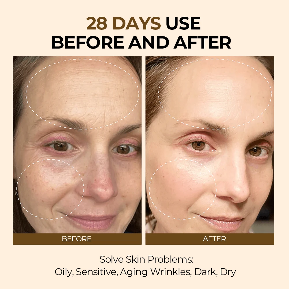 Private Label Organic 5 In 1 Facial Cream Hyaluronic Acid 30% Vitamin C 10% Pro xyline Collagen Anti Aging Whitening Face Cream
