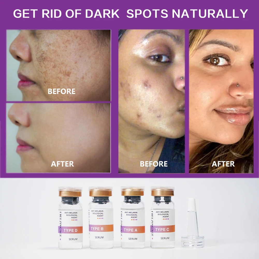 Private Label OEM Anti Aging Wrinkle Firming Brightening Skin Care Hyaluronic Acid and Vitamin E Face 2.5% Retinol Serum