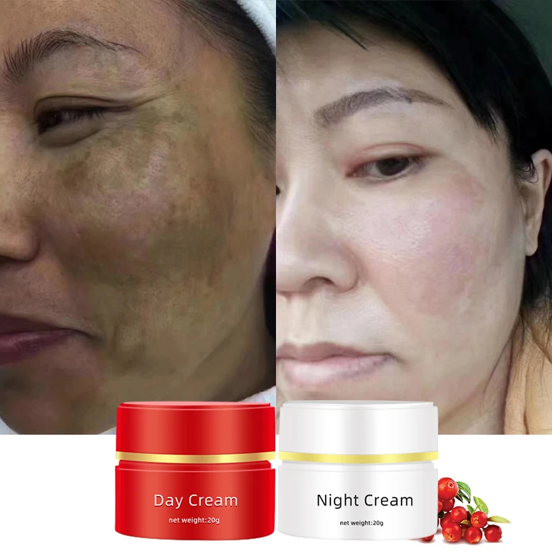 Japan Korean Hot Sales Luxury Well Packaged 1 Day And Night Cream Set Face Whitening Kit Cream In China Market