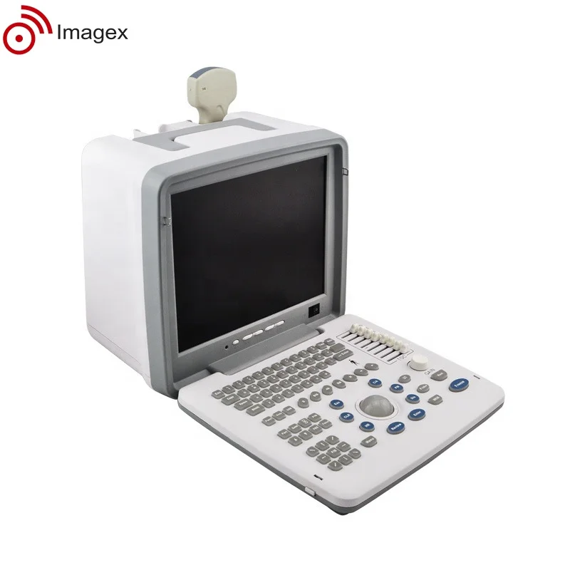 Factory Price Medical Ultrasound Scanner for Obstetric and Gynecological Use