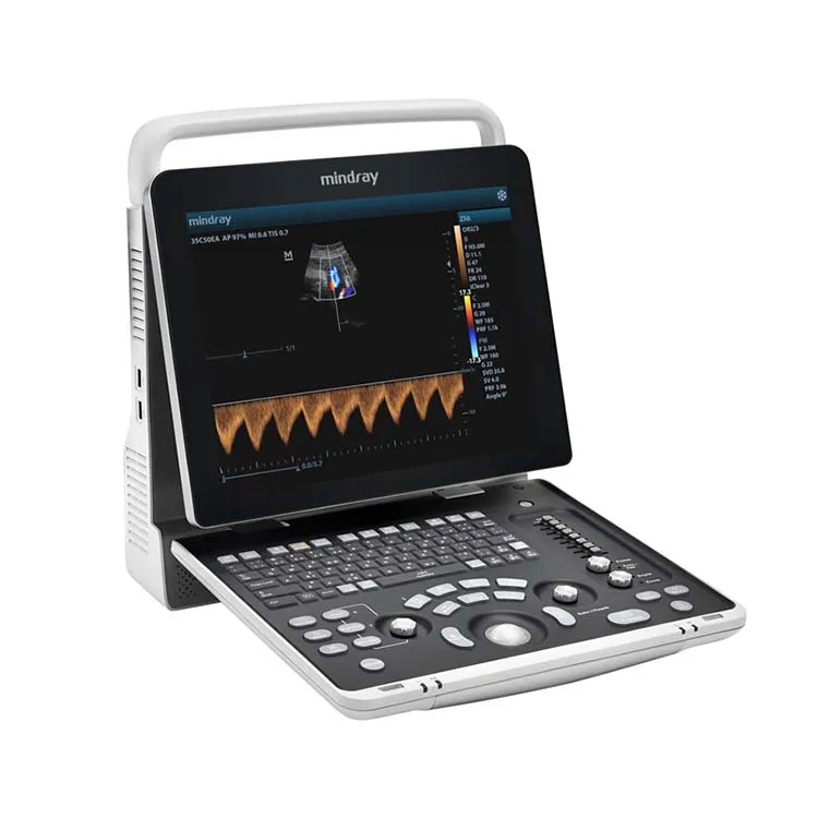 DP-10 Digital Diagnostic Mindray Ultrasound Machine Portable Doppler Medical Ultrasound Instruments