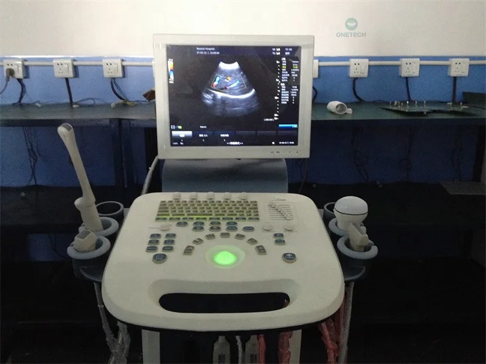 TC15 Mobile Color Doppler Digital Ultrasound 3d 4d Mult Probe Trolly Ultrasound Scanner Echo Ultrasound Machine For Pregnancy