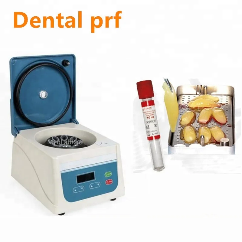 prf centrifuge dental