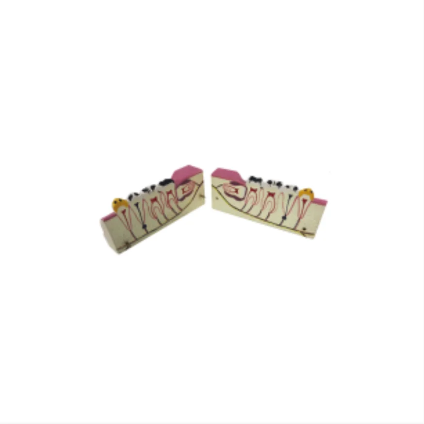 ADA Medical science magnified model of molars and caries decomposition model with tooth and model of root caries lesions