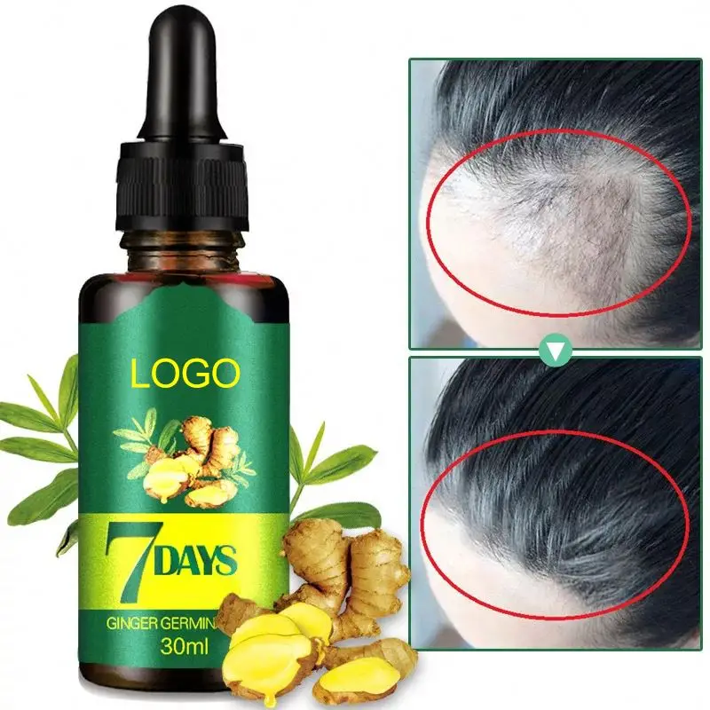 private label Wholesale 30ml Ginger Oil 7 Days Hair Growth Essential Oil For Hair Loss Treatment Regrowth Serum