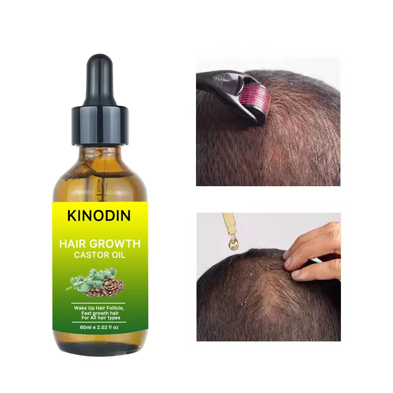 Private label 100% Natural Formula Nourishing Scalp Hair Growth Castor oil and magic Rosemary hair oil Serum