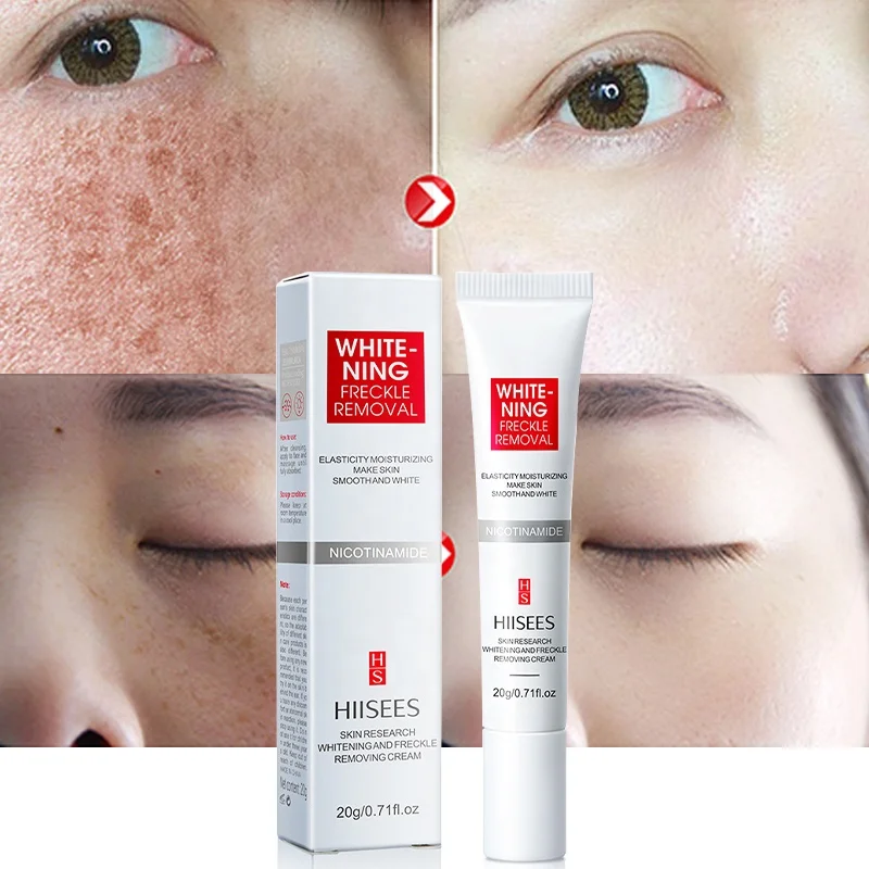 Remove Pigmentation Spots Melasma Melanin Anti Freckle Skin Face Cream For Glowing Skin Whitening Freckles Cream