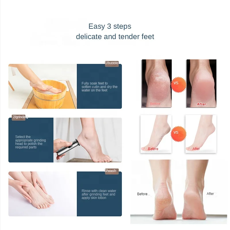 LED screen Electric Foot Callus Remover Electric Foot File Portable Foot Grinder