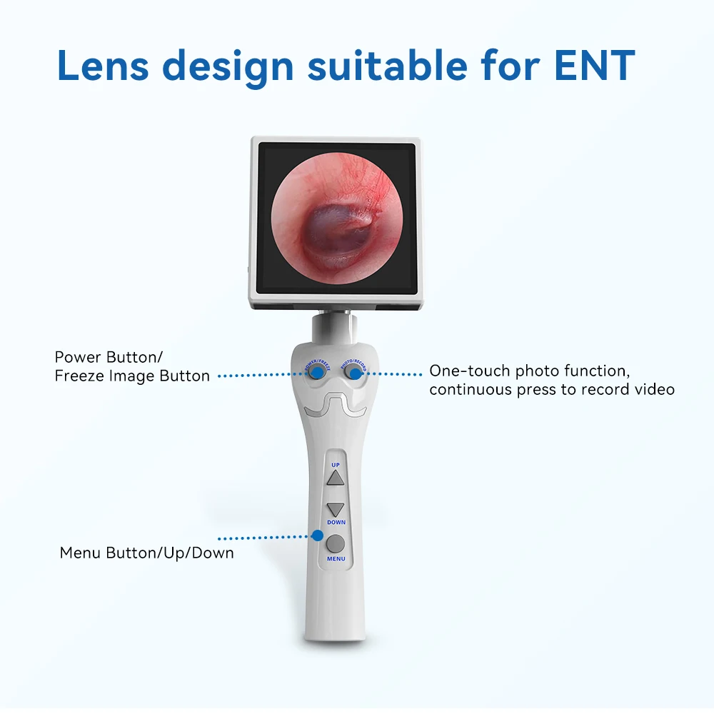 ENT Portable Medical Endoscope Equipment For ENT Diagnosis Teaching Practice OEM/ODM Service Endoscopy Imaging Equipment