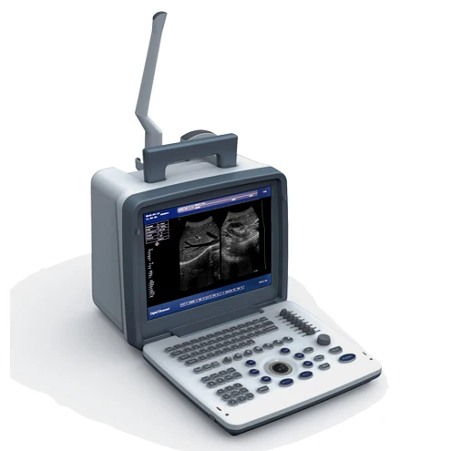 KBW-300 Laptop B&W Ultrasonic diagnostic portable B ultrasound scanner