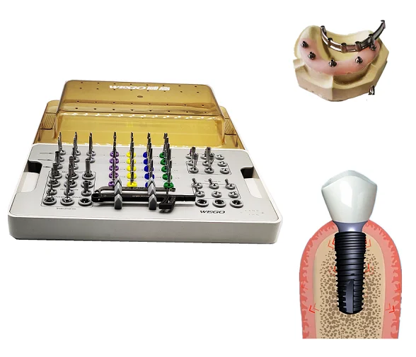 Многокомпонентная абажурная титановая основа для циркония индивидуальные стоматологические хирургические инструменты с асфейсным эффектом стоматологический инструмент из титанового