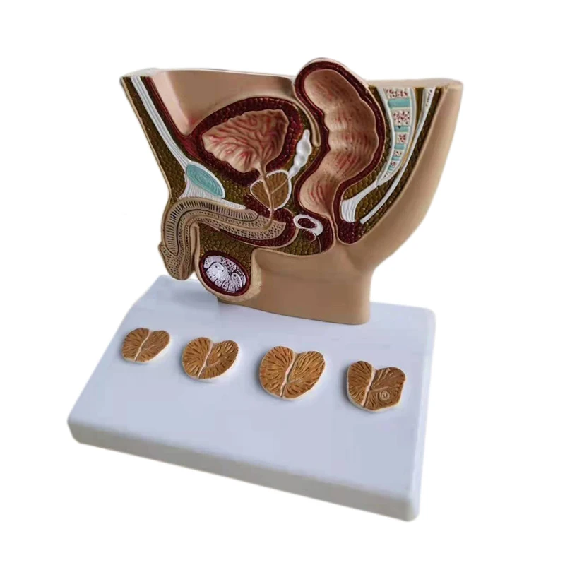 PVC human male pelvis Anatomical with prostate pathology  section medical science