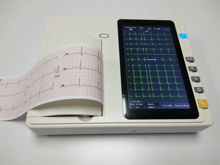 Digital Three Channel 12 lead ECG Machine CE Approved color Echocardiogram