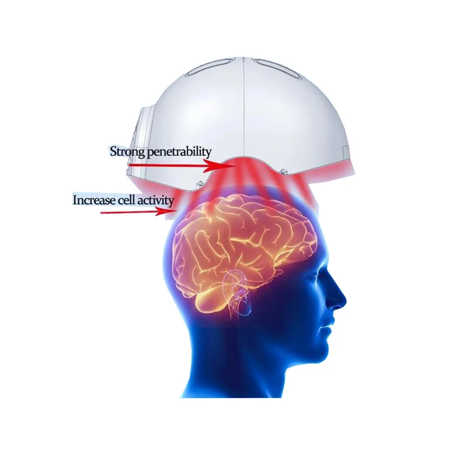 Infrared light brain therapies 810nm RTMS brain neuron stimulation helmet Stroke Depression treat helmet